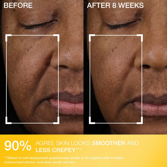 Peptight® Face Lift Serum