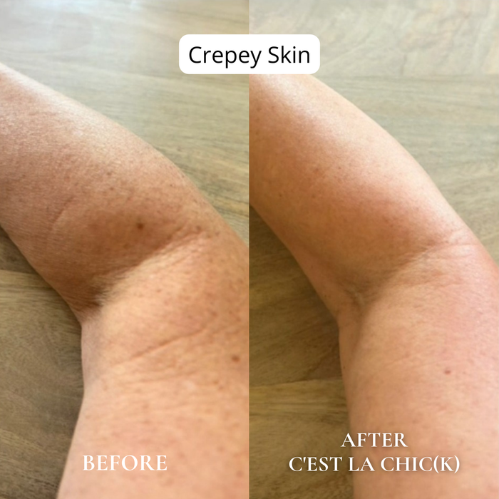 C'est la Chic(k) : Eggshell Membrane Collagen Scrub Soap Set