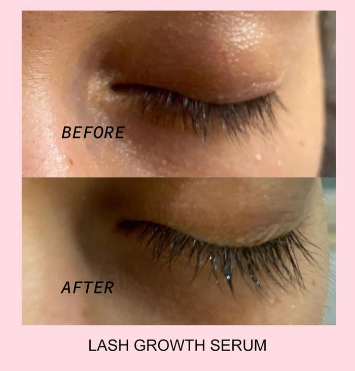 Eyelash Growth Serum