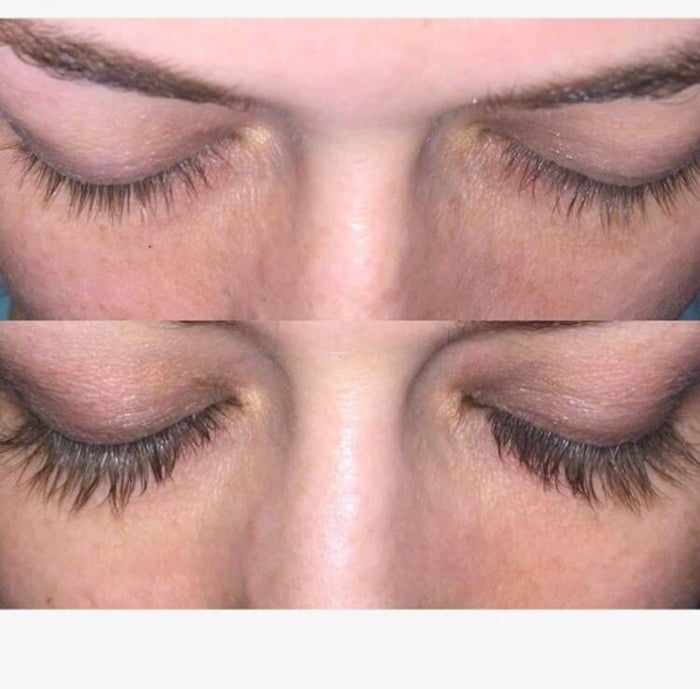 Eyelash Growth Serum