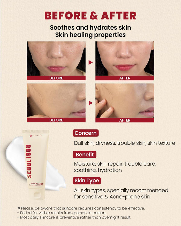 K-SECRET SEOUL 1988 Cream - Snail Mucin 93% + Rice 100 mL