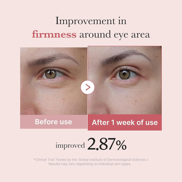 Medicube PDRN Pink Peptide Eye Serum 30 mL