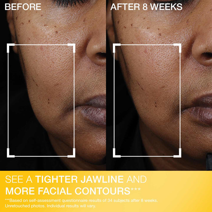 Peptight® Face Lift Serum