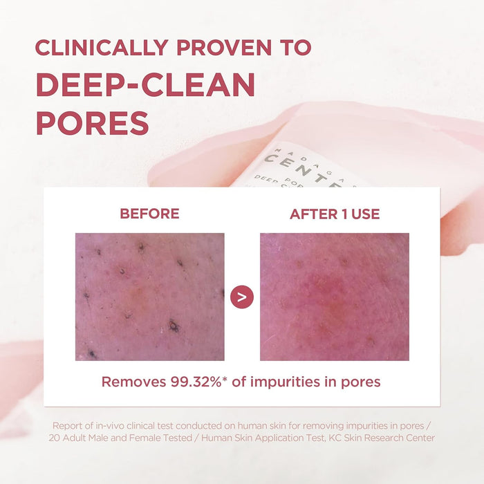 SKIN1004 Centella Poremizing Deep Cleansing Foam 125ml | VGLE Beauty Canada