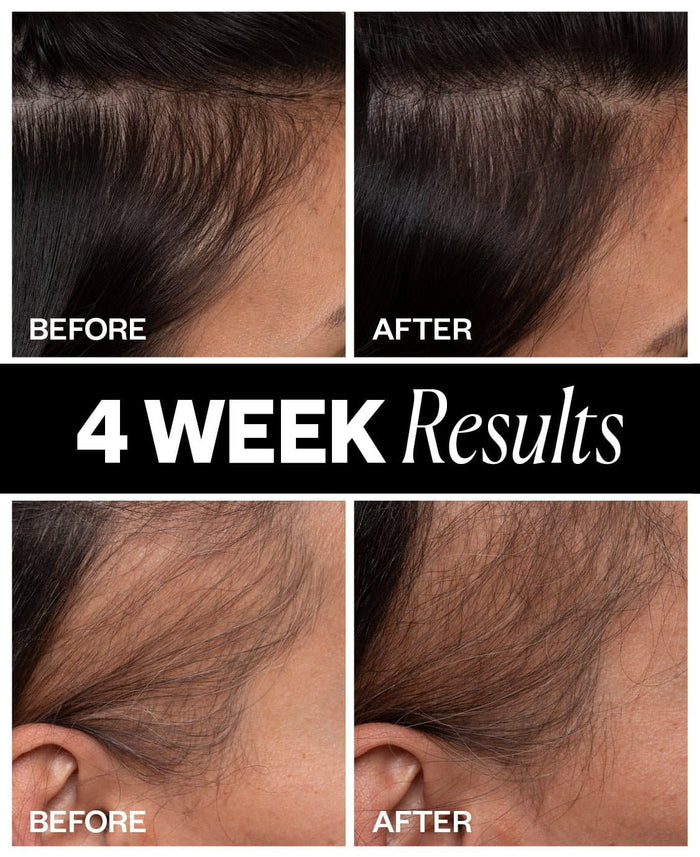 SPONSORED Hair Density Scalp Treatment