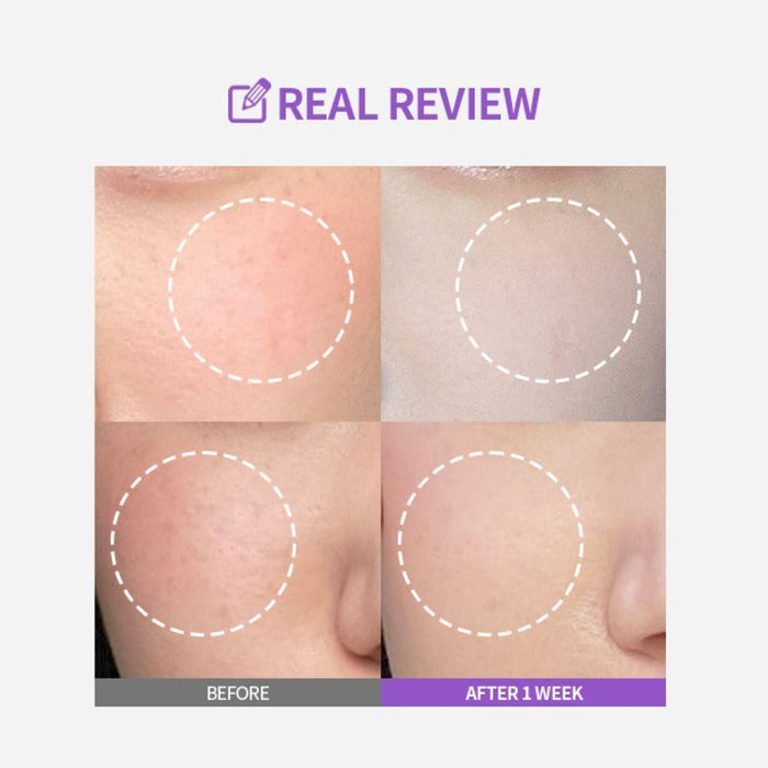 Sungboon Editor Meoru Podo Vita C Dark Spot Ampoule 30 mL