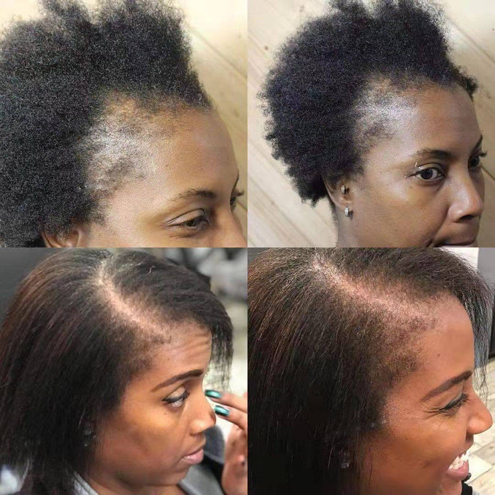 Wonder Scalp Stimulator Hair Growth Oil 2oz