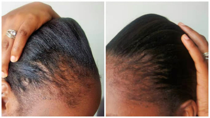 Wonder Scalp Stimulator Hair Growth Oil 2oz