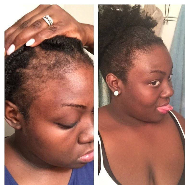 Wonder Scalp Stimulator Hair Growth Oil 2oz